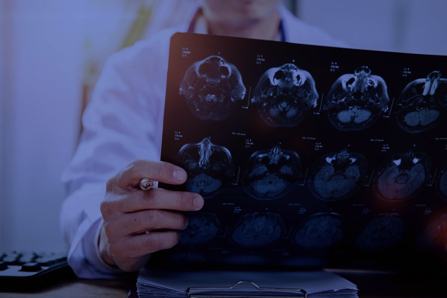 Outsourcing Options for Neurology Billing