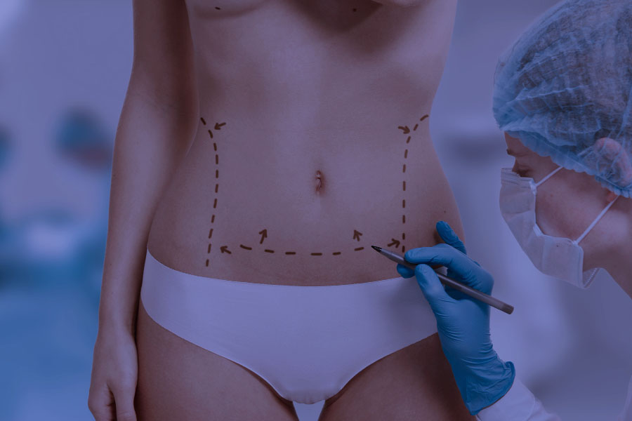 Outsourcing Solutions fot Plastic Surgery Guidelines