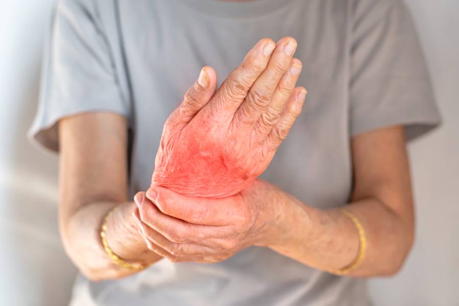 What is Rheumatoid Arthritis