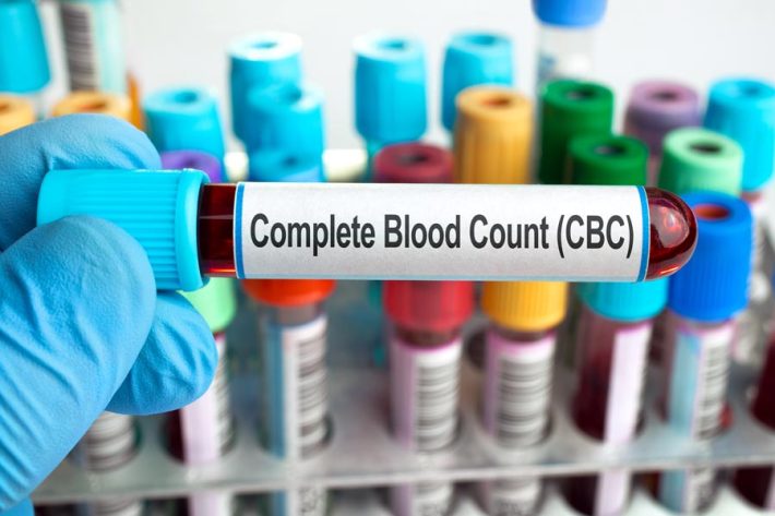 Laboratory CPT Codes: The Most Commonly Used Tests